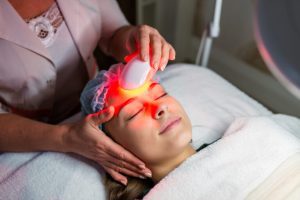 Intense Pulsed Light (IPL)