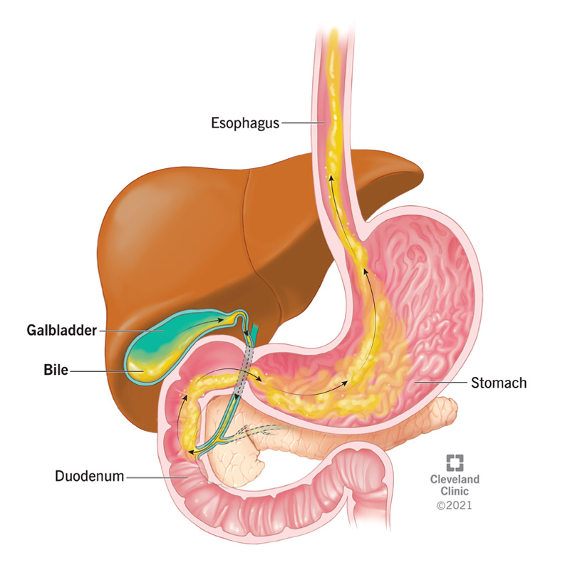 What Is Bile?