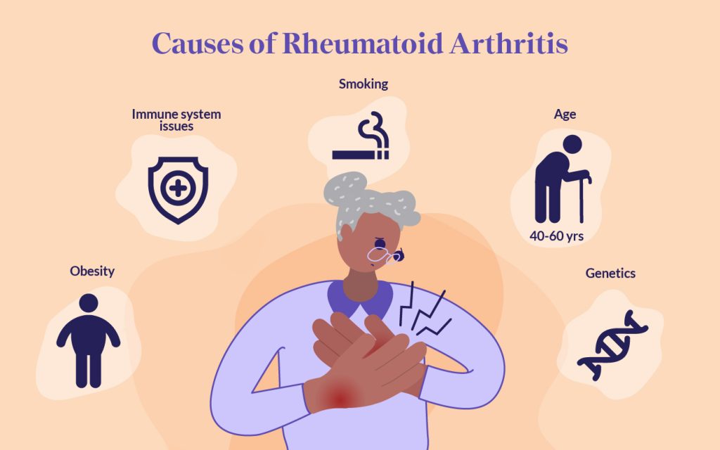 Etiology of Rheumatoid Arthritis