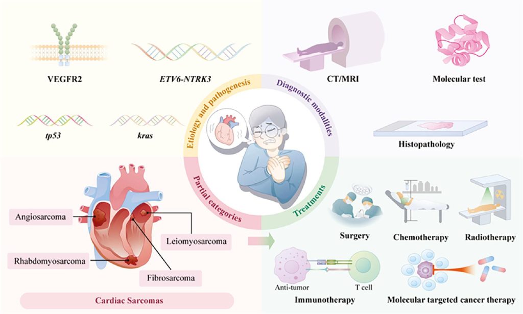 Etiology of Sarcoma: Everything You Need to Know