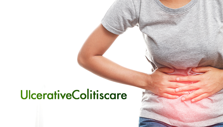 Etiology of Ulcerative Colitis