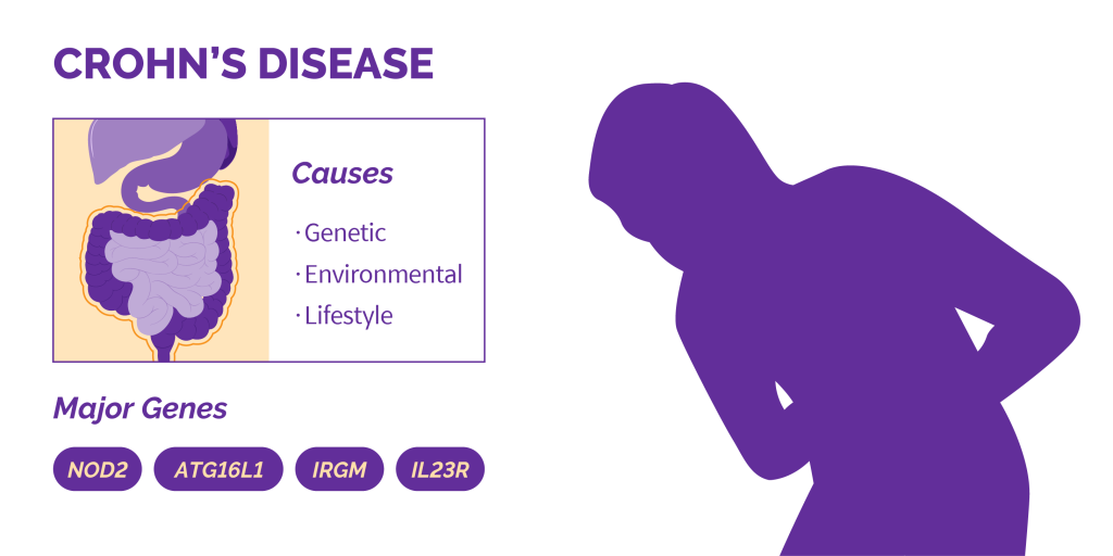 Etiology of Crohn’s Disease