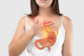 Gastroesophageal Reflux Disease (GERD) - Everything you need to know