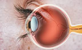 Retinal Disorders - Everything you need to know