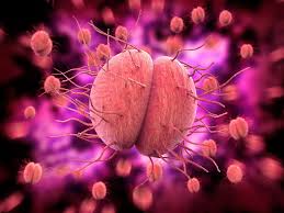 Gonorrhea – Everything you need to know