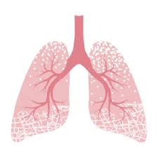 Asbestosis - Everything you need to know