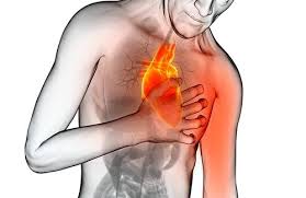 Angina Pectoris - Everything you need to know