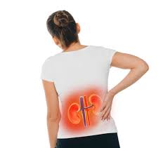 Kidney Disease Symptoms in Females - Everything you need to know