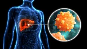 Hepatitis B - Everything you need to know