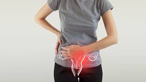 My First Symptoms of Ovarian Cancer