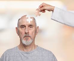 Transient Ischemic Attack