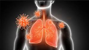 Respiratory Infection