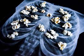 Popcorn Lung