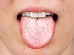 Dry Mouth Causes (xerostomia)