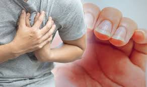 Heart Problem Symptoms – Everything you need to know