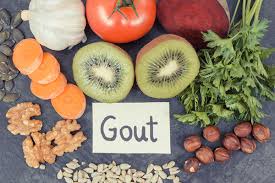 Foods That Cause Gout – Everything you need to know