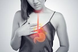 Acid Reflux – Everything you need to know