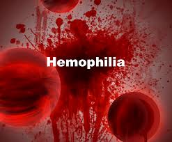 Hemophilia – Everything you need to know