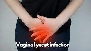 Vaginal Yeast Infection - Everything you need to know